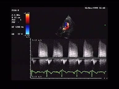 Die Echokardiographie (Herzultraschall) dient in der Praxisklinik Bornheim bei Köln Bonn zur Diagnose von Herz-Krankheiten