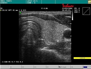 Schilddrüsen-Sonographie | Praxisklinik Bornheim | Köln-Bonn