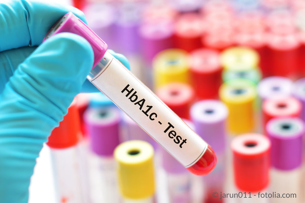 HbA1c : Blutzucker - Langzeitwert bei Diabetes mellitus