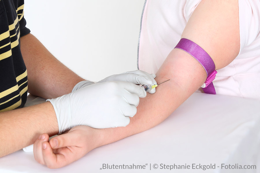 Blutentnahme beim Leber-Check: Anhand der Leberwerte kann eine Leber Schädigung ermittelt werden