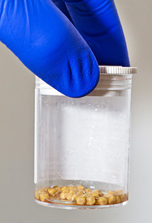 © Jürgen Fälchle - Fotolia.com | "Gallensteine im Becher" © Jürgen Fälchle - Fotolia.com |