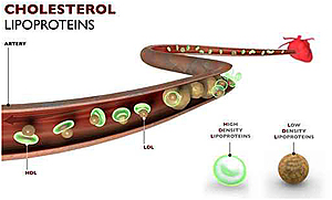 Blutfette Transport per High Density Proteine (HDL), Low Density Proteine (LDL) und Lipoprotein a Lp(a)