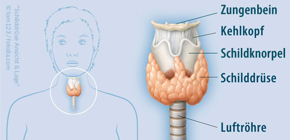 Schilddrüsenknoten – sind auch sehr oft gutartig